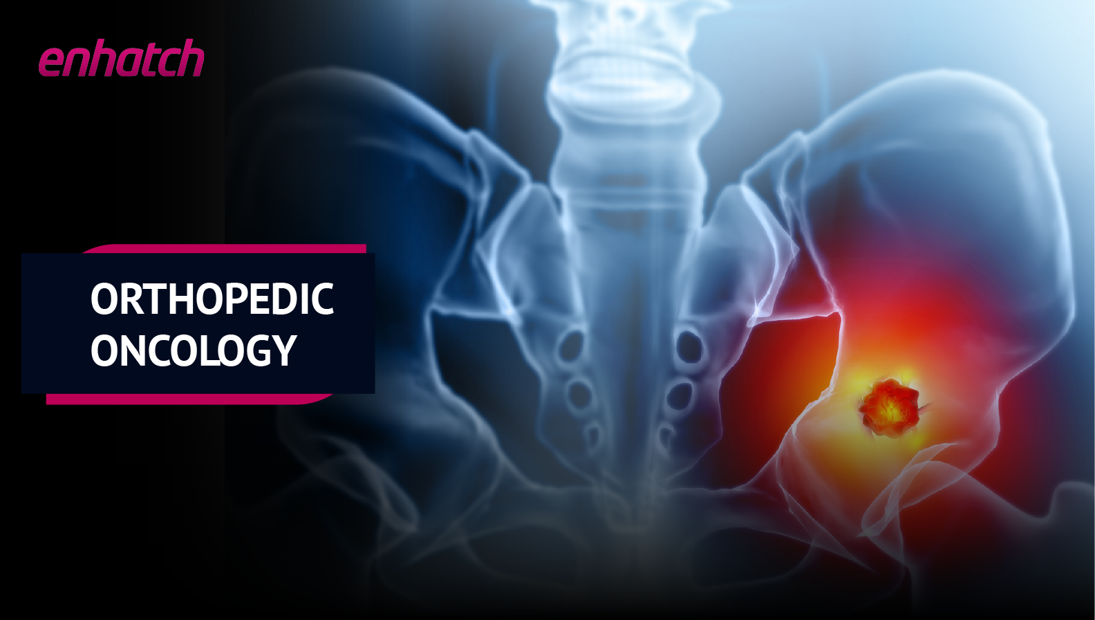 Orthopedic oncologists near me